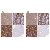 Anti-ABAT antibody produced in rabbit Prestige Antibodies® Powered by Atlas Antibodies, affinity isolated antibody, buffered aqueous glycerol solution