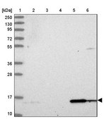 Anti-DUSP23 antibody produced in rabbit Prestige Antibodies® Powered by Atlas Antibodies, affinity isolated antibody, buffered aqueous glycerol solution