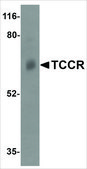 Anti-TCCR (ab1) antibody produced in rabbit affinity isolated antibody, buffered aqueous solution