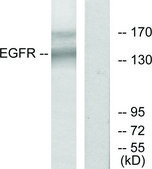 Anti-EGFR antibody produced in rabbit affinity isolated antibody