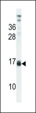 ANTI-LALBA (CENTER) antibody produced in rabbit affinity isolated antibody, buffered aqueous solution