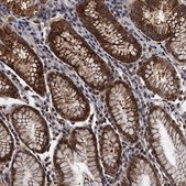 Anti-PTCD3 antibody produced in rabbit Prestige Antibodies® Powered by Atlas Antibodies, affinity isolated antibody, buffered aqueous glycerol solution