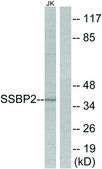 Anti-SSBP2 antibody produced in rabbit affinity isolated antibody