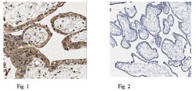 Anti-GPR30, clone 2F2 Antibody clone 2F2, from mouse