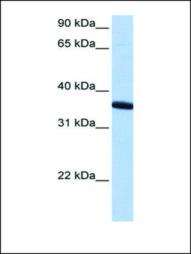 Anti-ZNF389 antibody produced in rabbit affinity isolated antibody