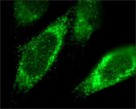 Anti-TFRC antibody produced in rabbit ~1.0&#160;mg/mL, affinity isolated antibody