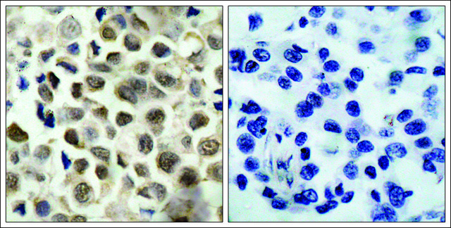 Anti-phospho-HDAC8 (pSer39) antibody produced in rabbit affinity isolated antibody