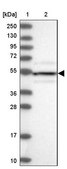 Anti-STK17A antibody produced in rabbit Prestige Antibodies&#174; Powered by Atlas Antibodies, affinity isolated antibody, buffered aqueous glycerol solution