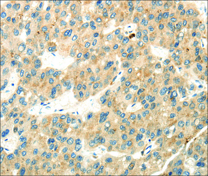 Anti-WDR36 affinity isolated antibody