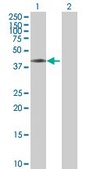 Anti-ASCC1 antibody produced in mouse IgG fraction of antiserum, buffered aqueous solution