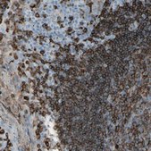 Anti-HLA-DPB1 antibody produced in rabbit Prestige Antibodies® Powered by Atlas Antibodies, affinity isolated antibody, buffered aqueous glycerol solution