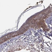 Anti-GJB4 antibody produced in rabbit Prestige Antibodies® Powered by Atlas Antibodies, affinity isolated antibody, buffered aqueous glycerol solution