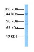 Anti-KIAA1199 antibody produced in rabbit affinity isolated antibody