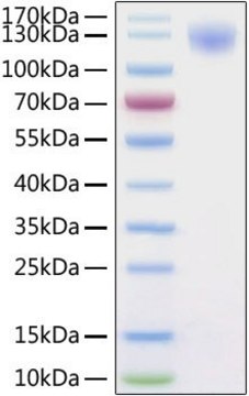 Recombinant 2019-nCoV Spike S1 Protein with His tag