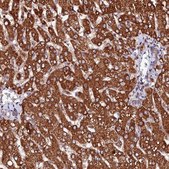 Anti-ST3GAL1 antibody produced in rabbit Prestige Antibodies® Powered by Atlas Antibodies, affinity isolated antibody, buffered aqueous glycerol solution