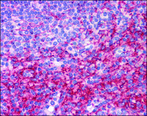 Anti-ATG9B / APG9L2 antibody produced in rabbit affinity isolated antibody