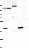 Anti-YIPF1 antibody produced in rabbit Prestige Antibodies® Powered by Atlas Antibodies, affinity isolated antibody, buffered aqueous glycerol solution