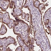 Anti-RASA1 antibody produced in rabbit Prestige Antibodies® Powered by Atlas Antibodies, affinity isolated antibody