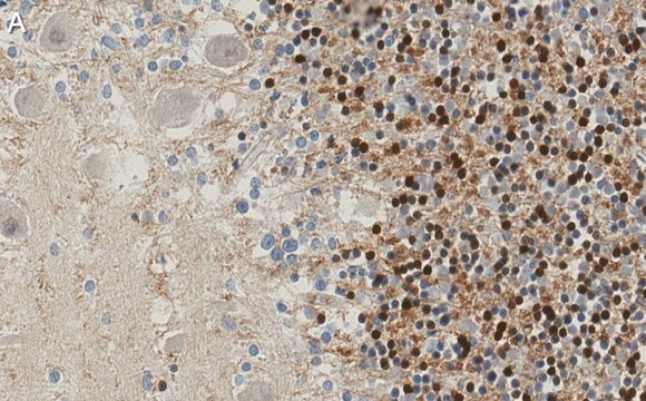 Anti-p27 Kip1 Antibody, clone 1B10 ZooMAb&#174; Rabbit Monoclonal recombinant, expressed in HEK 293 cells