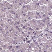Anti-RCOR3 antibody produced in rabbit Prestige Antibodies® Powered by Atlas Antibodies, affinity isolated antibody