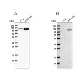 抗-AASS 兔抗 Prestige Antibodies® Powered by Atlas Antibodies, affinity isolated antibody, buffered aqueous glycerol solution, Ab2
