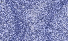 Anti-CCR2 Antibody, clone 5K5-3 ZooMAb® Rabbit Monoclonal recombinant, expressed in HEK 293 cells