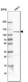 Anti-OGT antibody produced in rabbit Prestige Antibodies® Powered by Atlas Antibodies, affinity isolated antibody, buffered aqueous glycerol solution, ab2