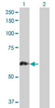 Anti-PRKCSH antibody produced in rabbit purified immunoglobulin, buffered aqueous solution