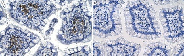 Anti-RANKL/TNFSF11 Antibody, clone 1H17 ZooMAb&#174; Rabbit Monoclonal recombinant, expressed in HEK 293 cells