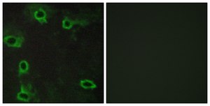 Anti-ADORA2A antibody produced in rabbit affinity isolated antibody