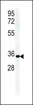 ANTI-ZDHC2 (N-TERMINAL) antibody produced in rabbit affinity isolated antibody, buffered aqueous solution