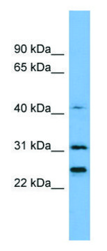 Anti-HIST1H1E (N-terminal) antibody produced in rabbit affinity isolated antibody