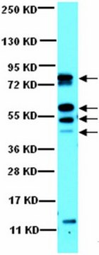 Anti-CaM Kinase II Antibody from rabbit, purified by affinity chromatography