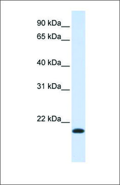 Anti-NKAIN1 antibody produced in rabbit affinity isolated antibody