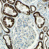 Anti-CPT1A antibody produced in rabbit Prestige Antibodies® Powered by Atlas Antibodies, affinity isolated antibody, buffered aqueous glycerol solution