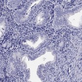 Anti-ALOX15B antibody produced in rabbit Prestige Antibodies® Powered by Atlas Antibodies, affinity isolated antibody
