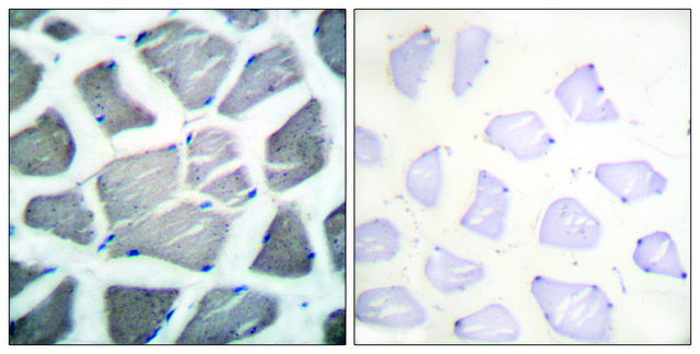 Anti-BAK antibody produced in rabbit affinity isolated antibody