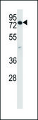 ANTI-CCDC22 (C-TERM) antibody produced in rabbit IgG fraction of antiserum, buffered aqueous solution