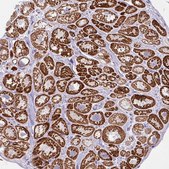 Anti-ANKRD1 antibody produced in rabbit Prestige Antibodies® Powered by Atlas Antibodies, affinity isolated antibody, buffered aqueous glycerol solution