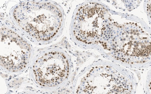 Anti-MGMT Antibody, clone 2N19 ZooMAb&#174; Rabbit Monoclonal recombinant, expressed in HEK 293 cells