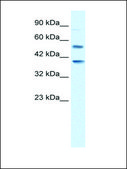 Anti-HTR3B antibody produced in rabbit affinity isolated antibody