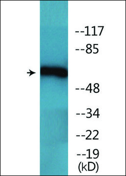 Anti-phospho-Chk2 (pThr68) antibody produced in rabbit affinity isolated antibody