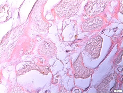 Amyloid TISSUE-TROL&#8482; Control Slides from human heart