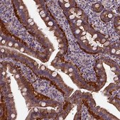 Anti-MVP antibody produced in rabbit Prestige Antibodies® Powered by Atlas Antibodies, affinity isolated antibody