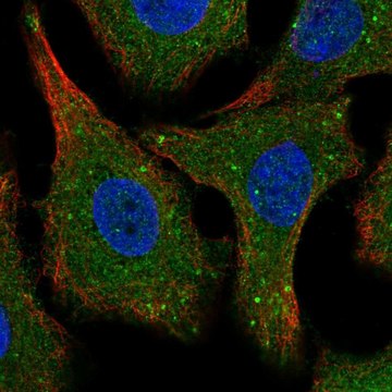 Anti-SPG21 antibody produced in rabbit Prestige Antibodies&#174; Powered by Atlas Antibodies, affinity isolated antibody