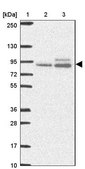 Anti-ABR antibody produced in rabbit Prestige Antibodies® Powered by Atlas Antibodies, affinity isolated antibody, buffered aqueous glycerol solution