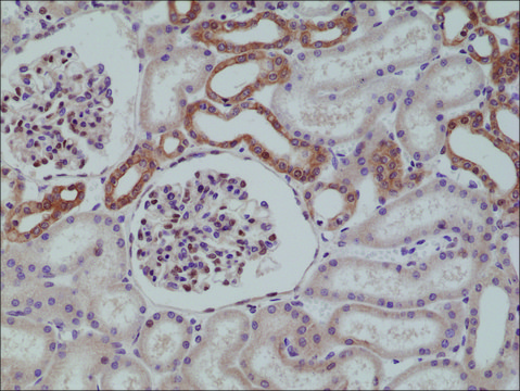 Anti-MYD88 antibody, Rabbit Monoclonal recombinant, expressed in HEK 293 cells, clone RM306, purified immunoglobulin