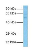 Anti-FBXL7 antibody produced in rabbit IgG fraction of antiserum