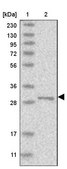 Anti-RSU1 antibody produced in rabbit Prestige Antibodies® Powered by Atlas Antibodies, affinity isolated antibody, buffered aqueous glycerol solution