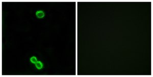 Anti-RPL3L antibody produced in rabbit affinity isolated antibody